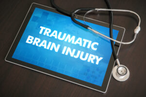 Traumatic-Brain-Injury-Claims-in-California