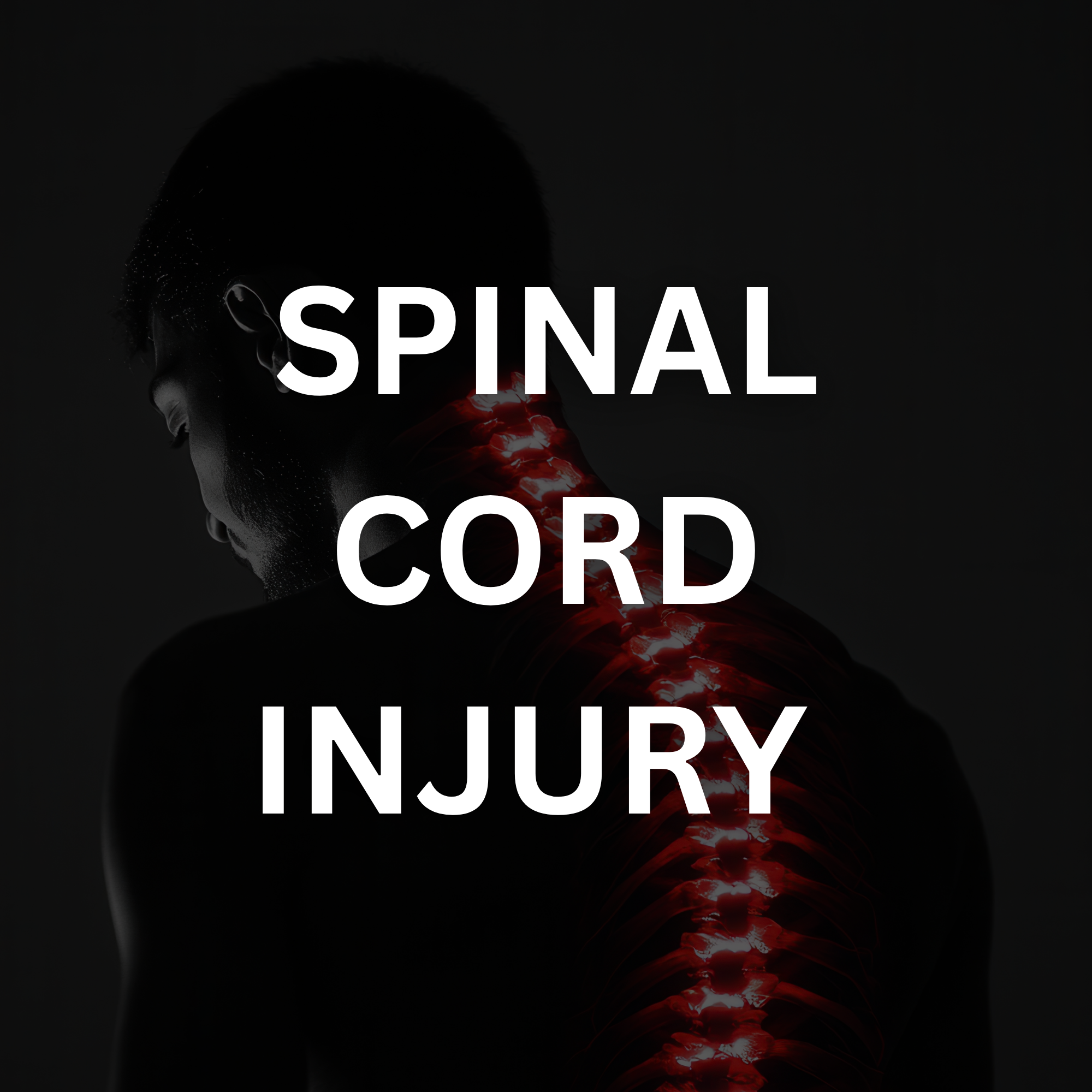 Spinal Cord Injury | Mesriani Law Group