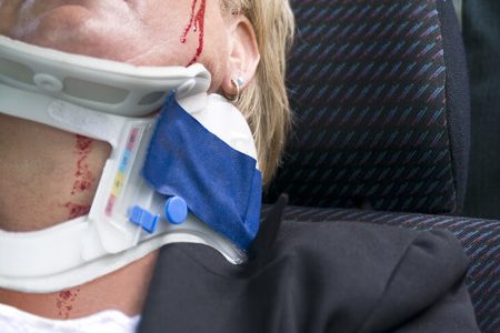 spinal-cord-injury-mlg